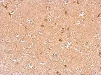 Anti-Dopamine beta Hydroxylase antibody used in IHC (Paraffin sections) (IHC-P). GTX101616