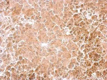 Anti-Dopamine beta Hydroxylase antibody used in IHC (Paraffin sections) (IHC-P). GTX101616