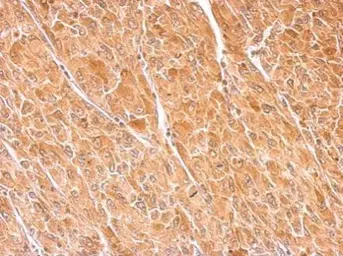 Anti-Dopamine beta Hydroxylase antibody used in IHC (Paraffin sections) (IHC-P). GTX101616