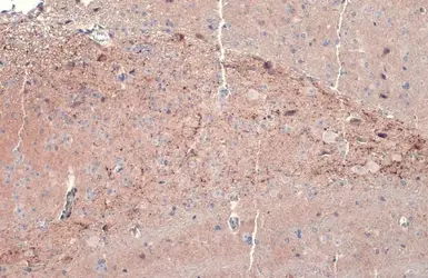 Anti-Dopamine beta Hydroxylase antibody used in IHC (Paraffin sections) (IHC-P). GTX101616