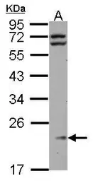 Anti-RPL11 antibody used in Western Blot (WB). GTX101651