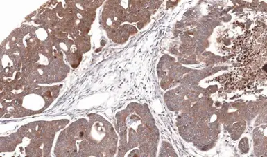 Anti-CDA antibody used in IHC (Paraffin sections) (IHC-P). GTX101673