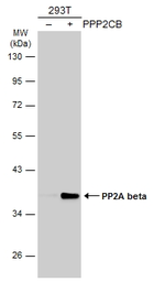 Anti-PP2A beta antibody used in Western Blot (WB). GTX101690