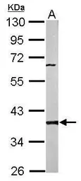 Anti-PP2A beta antibody used in Western Blot (WB). GTX101690