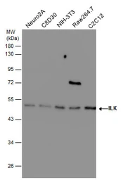 Anti-ILK antibody [N1C1] used in Western Blot (WB). GTX101691