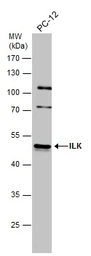 Anti-ILK antibody [N1C1] used in Western Blot (WB). GTX101691