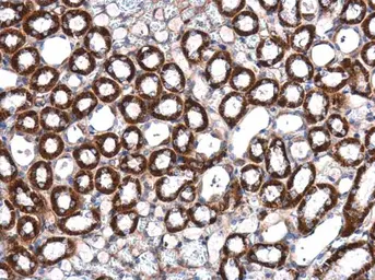 Anti-ILK antibody [N1C1] used in IHC (Paraffin sections) (IHC-P). GTX101691