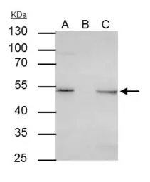 Anti-ILK antibody [N1C1] used in Immunoprecipitation (IP). GTX101691