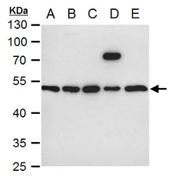 Anti-ILK antibody [N1C1] used in Western Blot (WB). GTX101691