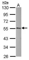 Anti-ILK antibody [N1C1] used in Western Blot (WB). GTX101691