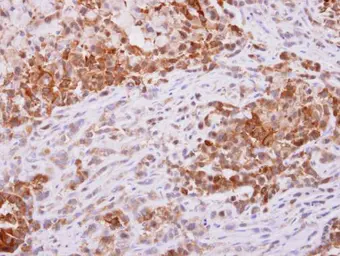 Anti-PGD antibody [N1N3] used in IHC (Paraffin sections) (IHC-P). GTX101703