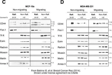 Anti-Moesin antibody [C2C3], C-term used in Western Blot (WB). GTX101708