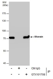 Anti-Moesin antibody [C2C3], C-term used in Immunoprecipitation (IP). GTX101708