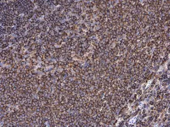 Anti-Moesin antibody [C2C3], C-term used in IHC (Paraffin sections) (IHC-P). GTX101708