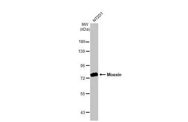 Anti-Moesin antibody [C2C3], C-term used in Western Blot (WB). GTX101708