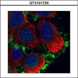 Anti-Moesin antibody [C2C3], C-term used in Immunocytochemistry/ Immunofluorescence (ICC/IF). GTX101708