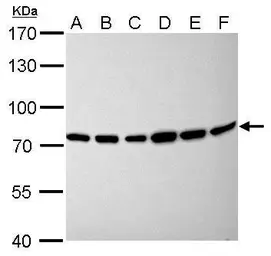 Anti-Moesin antibody [C2C3], C-term used in Western Blot (WB). GTX101708