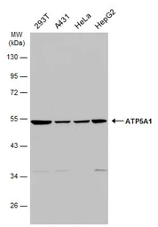 Anti-ATP5A1 antibody [C2C3], C-term used in Western Blot (WB). GTX101741