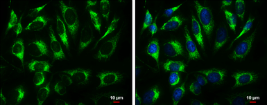 Anti-ATP5A1 antibody [C2C3], C-term used in Immunocytochemistry/ Immunofluorescence (ICC/IF). GTX101741