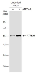 Anti-ATP5A1 antibody [C2C3], C-term used in Western Blot (WB). GTX101741