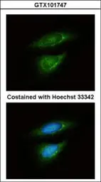 Anti-LDH-B antibody used in Immunocytochemistry/ Immunofluorescence (ICC/IF). GTX101747