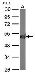 Anti-Creatine kinase (brain) antibody [N3C3] used in Western Blot (WB). GTX101760