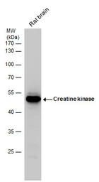 Anti-Creatine kinase (brain) antibody [N3C3] used in Western Blot (WB). GTX101760