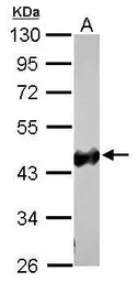 Anti-Creatine kinase (brain) antibody [N3C3] used in Western Blot (WB). GTX101760