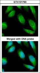 Anti-Creatine kinase (brain) antibody [N3C3] used in Immunocytochemistry/ Immunofluorescence (ICC/IF). GTX101760