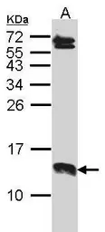 Anti-SERP1/2 antibody used in Western Blot (WB). GTX101783