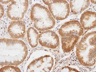 Anti-ENO1 antibody [N3C3] used in IHC (Paraffin sections) (IHC-P). GTX101803