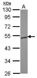 Anti-ENO1 antibody [N3C3] used in Western Blot (WB). GTX101803