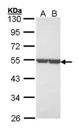 Anti-ENO1 antibody [N3C3] used in Western Blot (WB). GTX101803