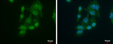 Anti-AUF1 antibody [N1C1] used in Immunocytochemistry/ Immunofluorescence (ICC/IF). GTX101813