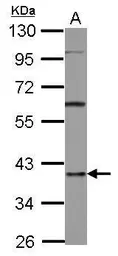 Anti-AUF1 antibody [N1C1] used in Western Blot (WB). GTX101813