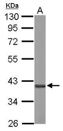 Anti-AUF1 antibody used in Western Blot (WB). GTX101814