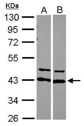 Anti-AUF1 antibody used in Western Blot (WB). GTX101814