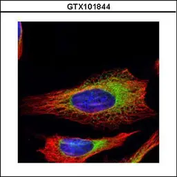 Anti-Ribosome binding protein 1 antibody [C3], C-term used in Immunocytochemistry/ Immunofluorescence (ICC/IF). GTX101844