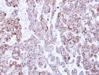 Anti-Ribosome binding protein 1 antibody [C3], C-term used in IHC (Paraffin sections) (IHC-P). GTX101844