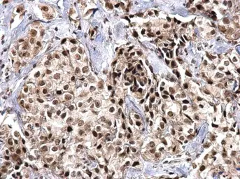 Anti-SNRPD2 antibody used in IHC (Paraffin sections) (IHC-P). GTX101846