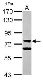 Anti-Ku70 antibody [N1N3] used in Western Blot (WB). GTX101848