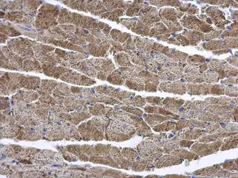 Anti-ENTPD6 antibody [N1C1] used in IHC (Paraffin sections) (IHC-P). GTX101851