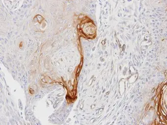 Anti-ENTPD6 antibody [N1C1] used in IHC (Paraffin sections) (IHC-P). GTX101851