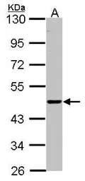 Anti-ENTPD6 antibody [N1C1] used in Western Blot (WB). GTX101851