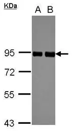 Anti-PRKCSH antibody used in Western Blot (WB). GTX101856