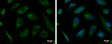 Anti-PRKCSH antibody used in Immunocytochemistry/ Immunofluorescence (ICC/IF). GTX101856