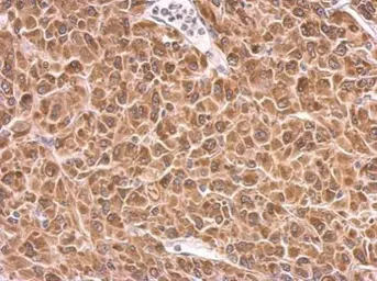 Anti-PRKCSH antibody used in IHC (Paraffin sections) (IHC-P). GTX101856