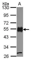 Anti-CD2 antibody [C1C3] used in Western Blot (WB). GTX101858