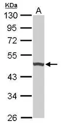 Anti-UQCRC1 antibody [N1N3] used in Western Blot (WB). GTX101862