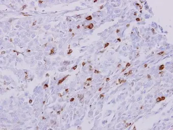 Anti-HLA-DRA antibody used in IHC (Paraffin sections) (IHC-P). GTX101865